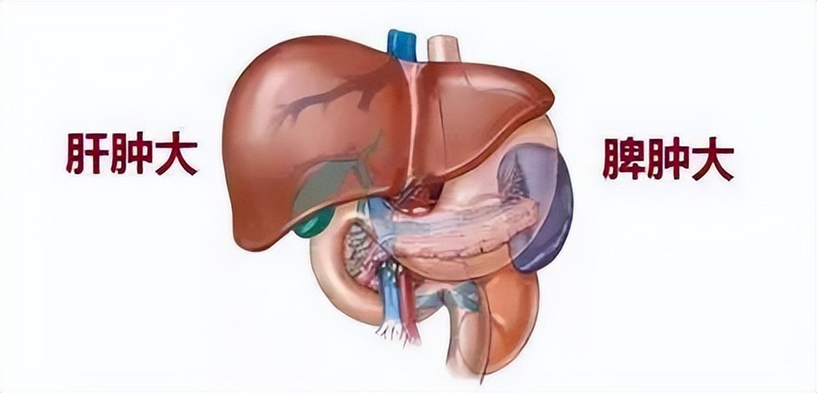 特发性血小板减少性紫癜    部分血小板减少患者会发生脾肿大现象,这
