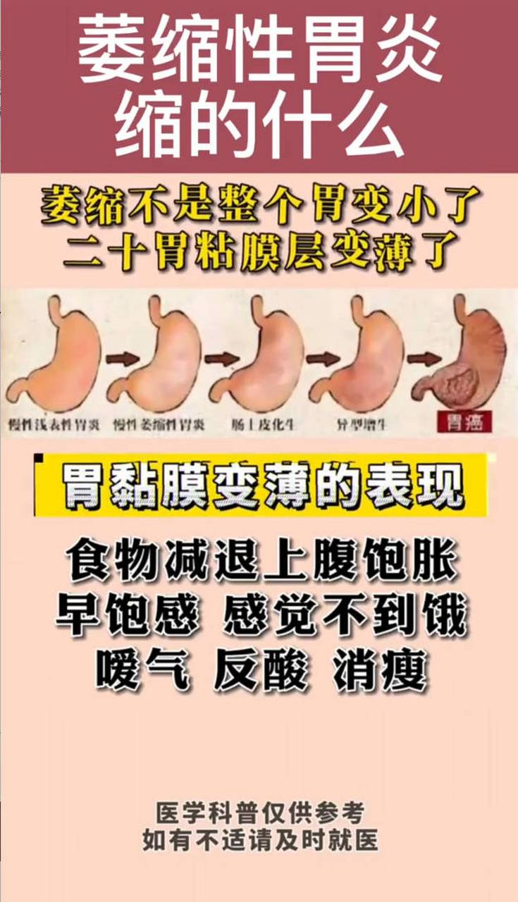 萎缩性胃炎,是通过c1 c2 c3来划分病变的范围,之后