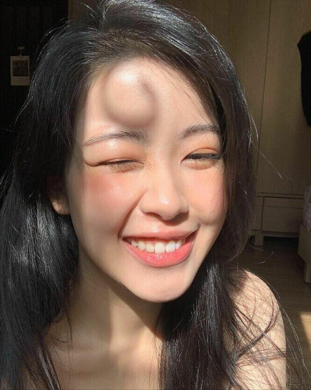 这是撞哪里了,这么大一个包.