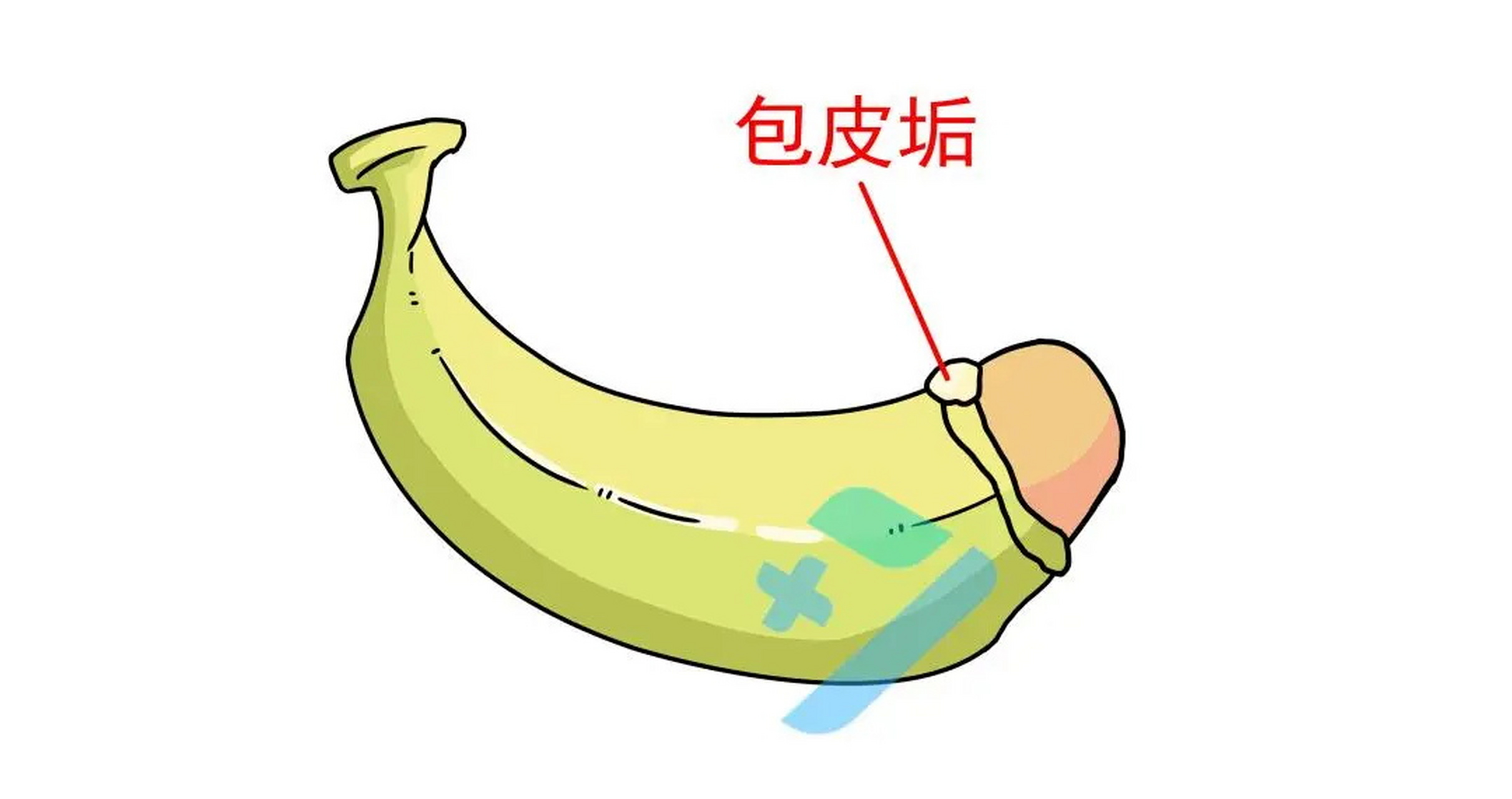 大人包茎需要治疗吗?