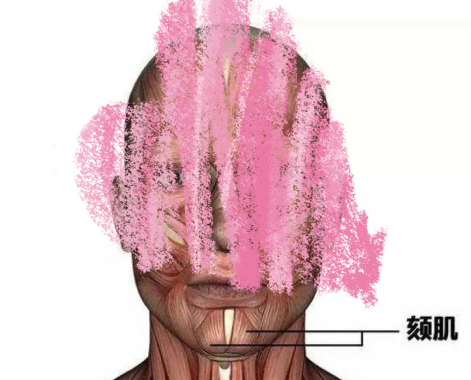 今天来跟大家聊聊颏肌放松,起因是一个宝宝来咨询下巴橘皮样皱褶,她的