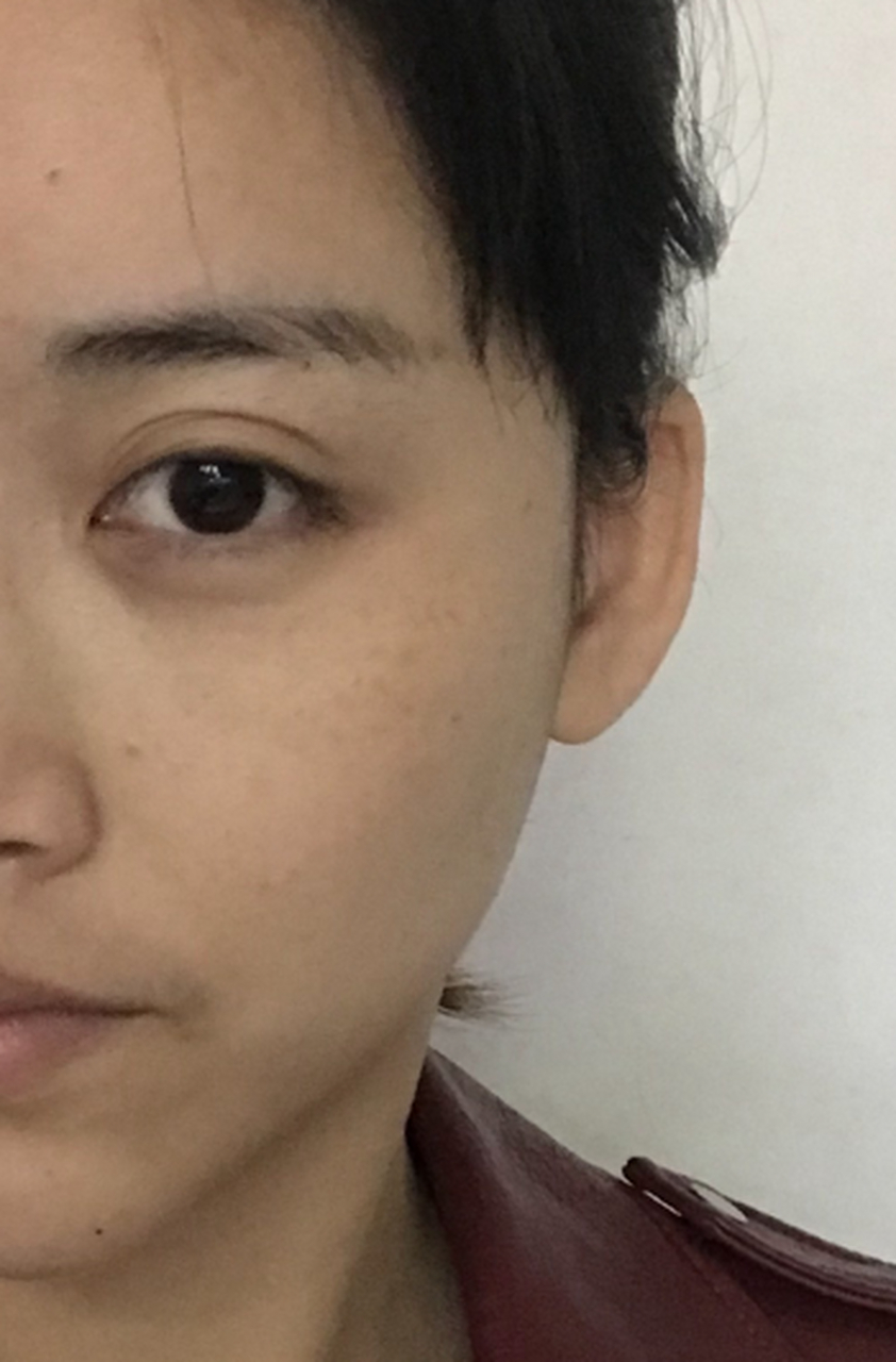 #彩光嫩肤# 皮肤暗沉发黄是什么原因 皮肤暗沉发黄,可能是因为天生遗