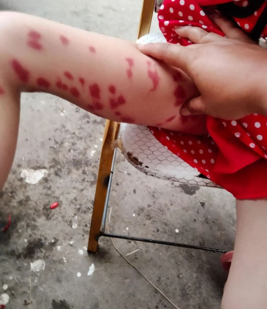 你说是什么虫子咬的. 放学回来,我说妈妈的腿好痒. 一只蚊子咬了我.