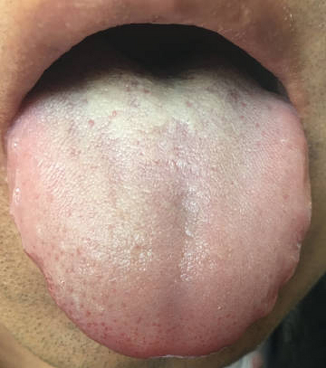 不知道是看偏颇了,还是经验所致,前医用了一派温补