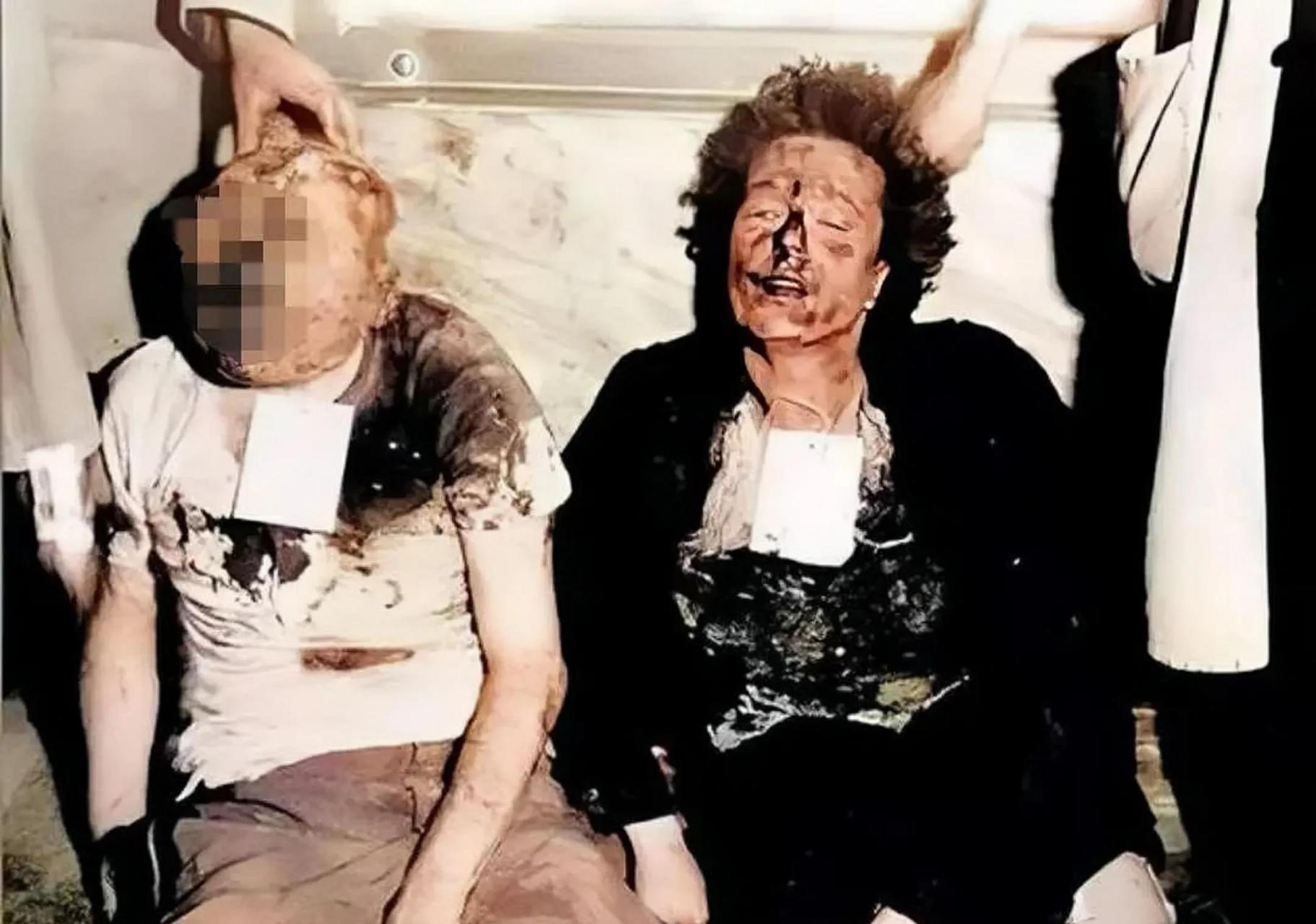 这张照片特别惨烈,照片拍摄于1945年,照片中的人物就是墨索里尼和他的