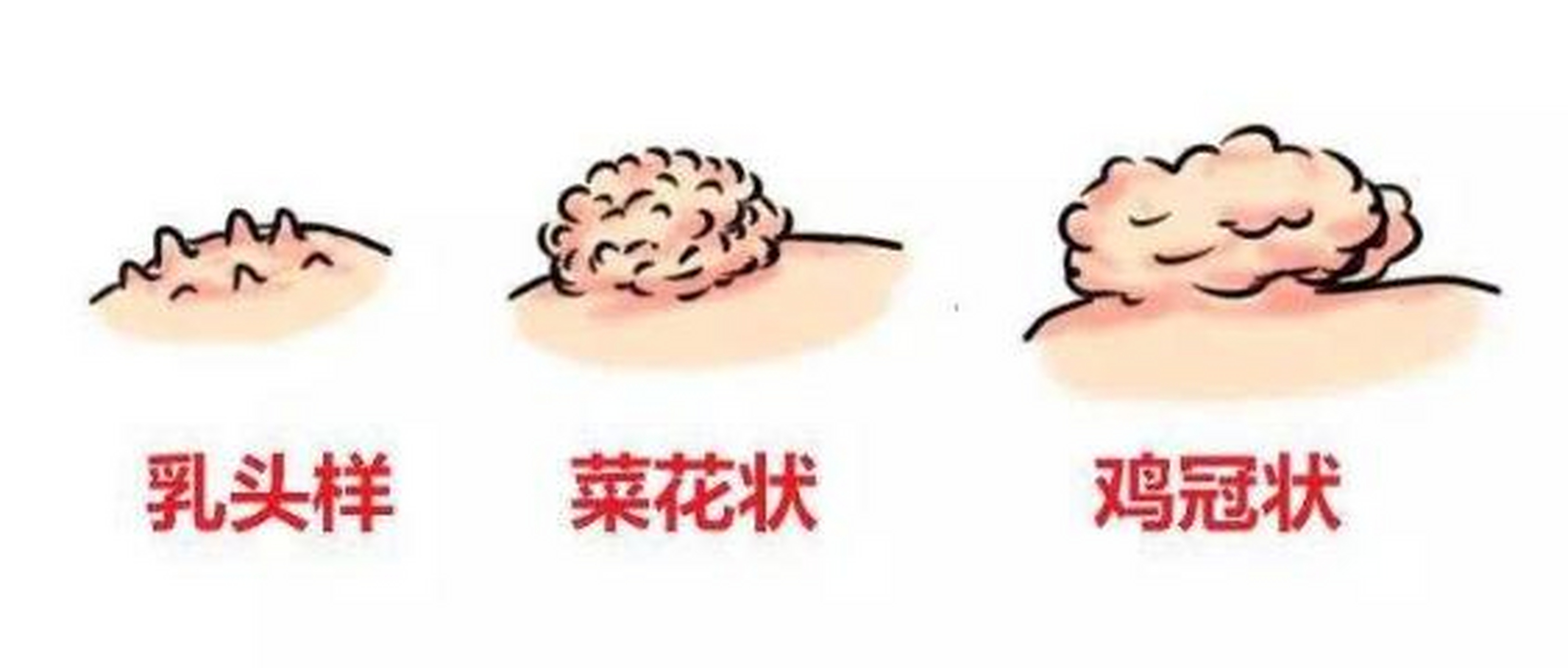 7岁小女孩下体竟长出"菜花",妈妈痛哭,都怪我!