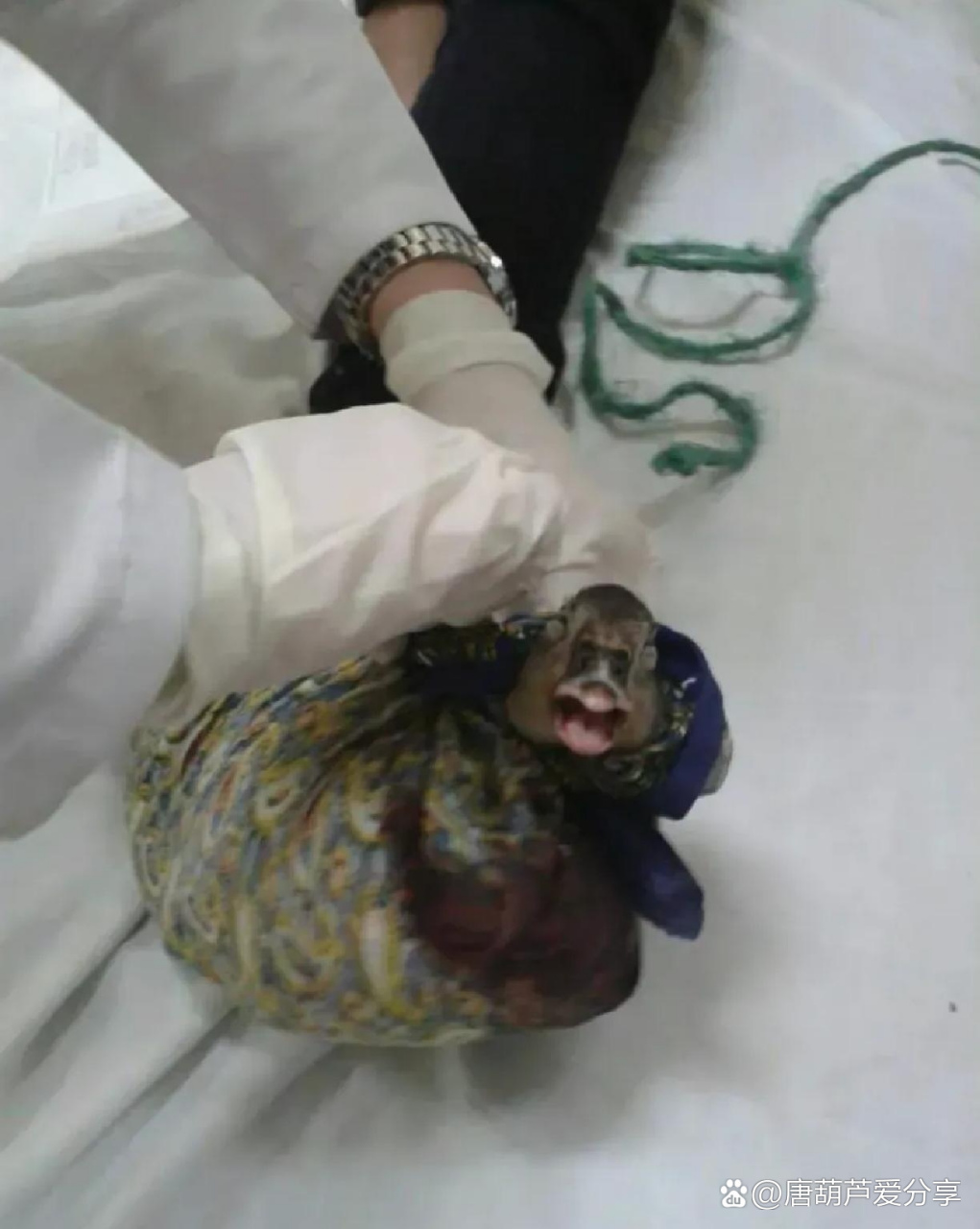 被蛇咬了,我妈立即给我绑了个鸭子啥意思?[捂脸]