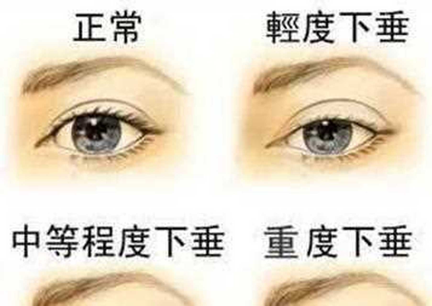 [二哈] 眼睛无神一方面可能眼睛本身是存在上眼睑提肌无力的现象