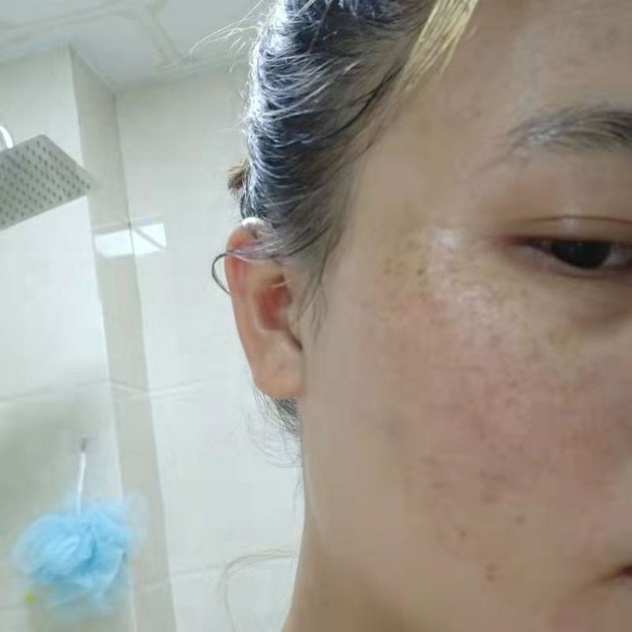 1个汤,淡化脸上黄褐斑  颧骨,脸颊对称长着棕色的斑块,这是黄褐斑