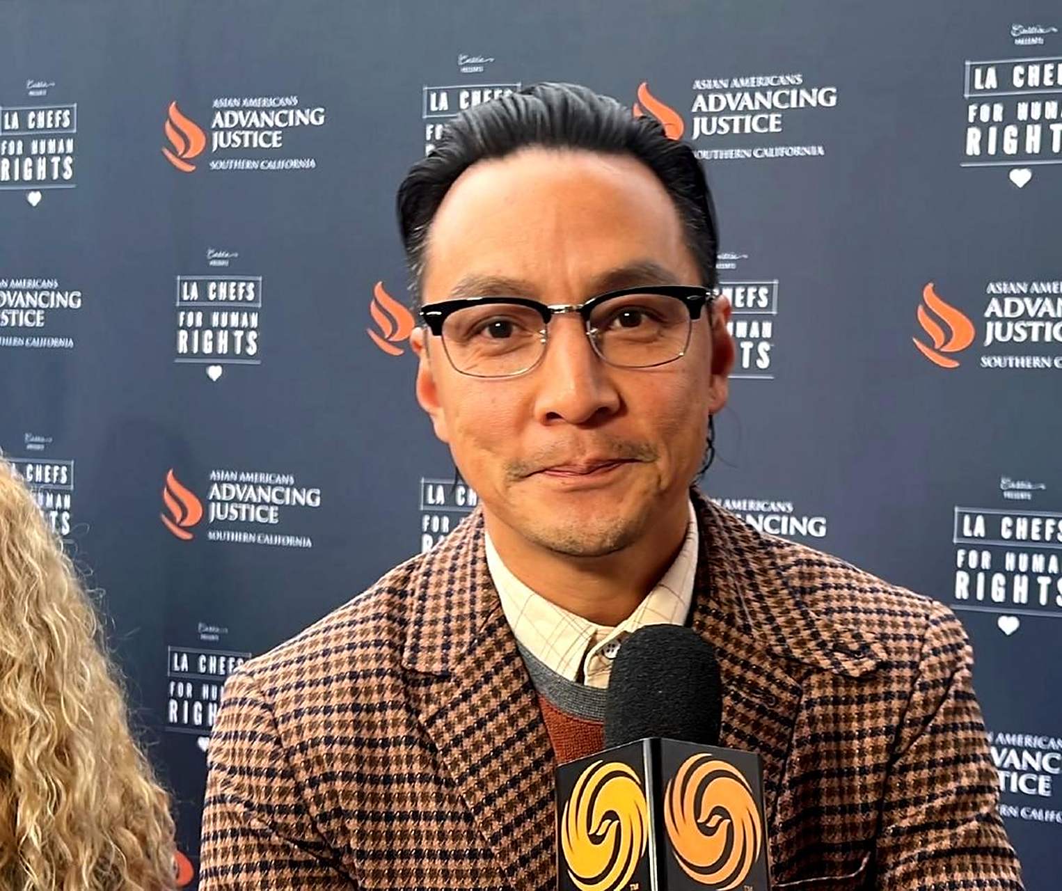 吴彦祖最近的照片显示他的发际线有些后退.