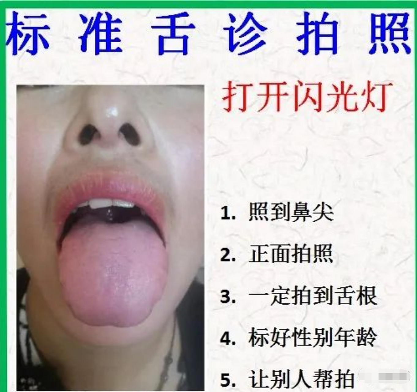 教你怎么拍一张合格的舌苔 建议你餐后1小时以后拍