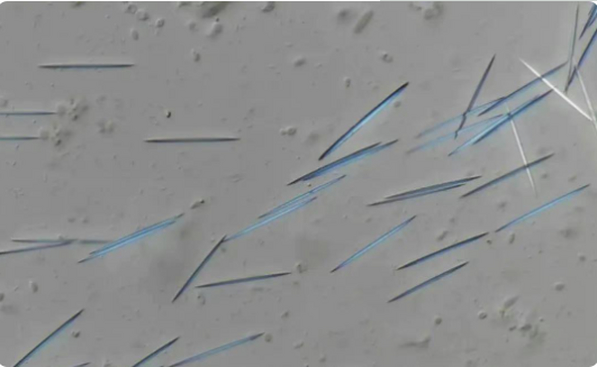 伞蕈切片在显微镜下图片