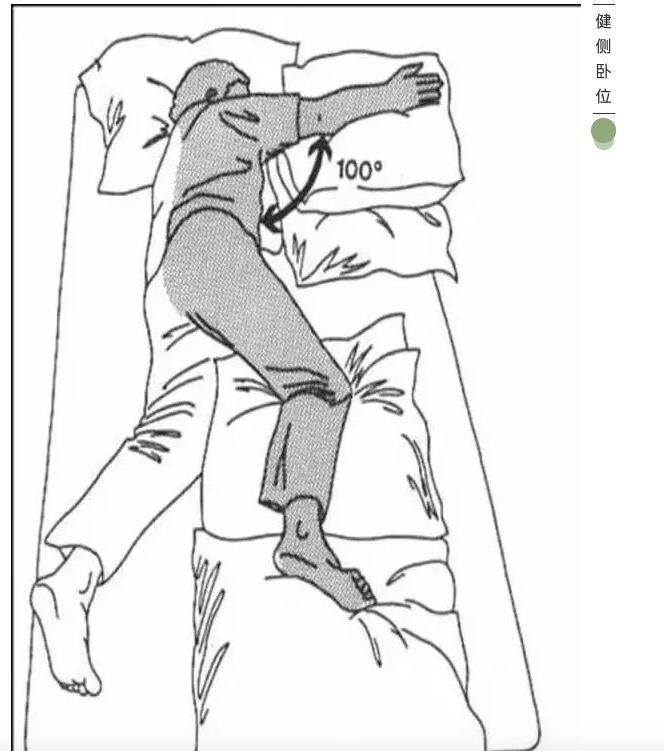 脑梗偏瘫后的良肢位摆放,你知道吗?