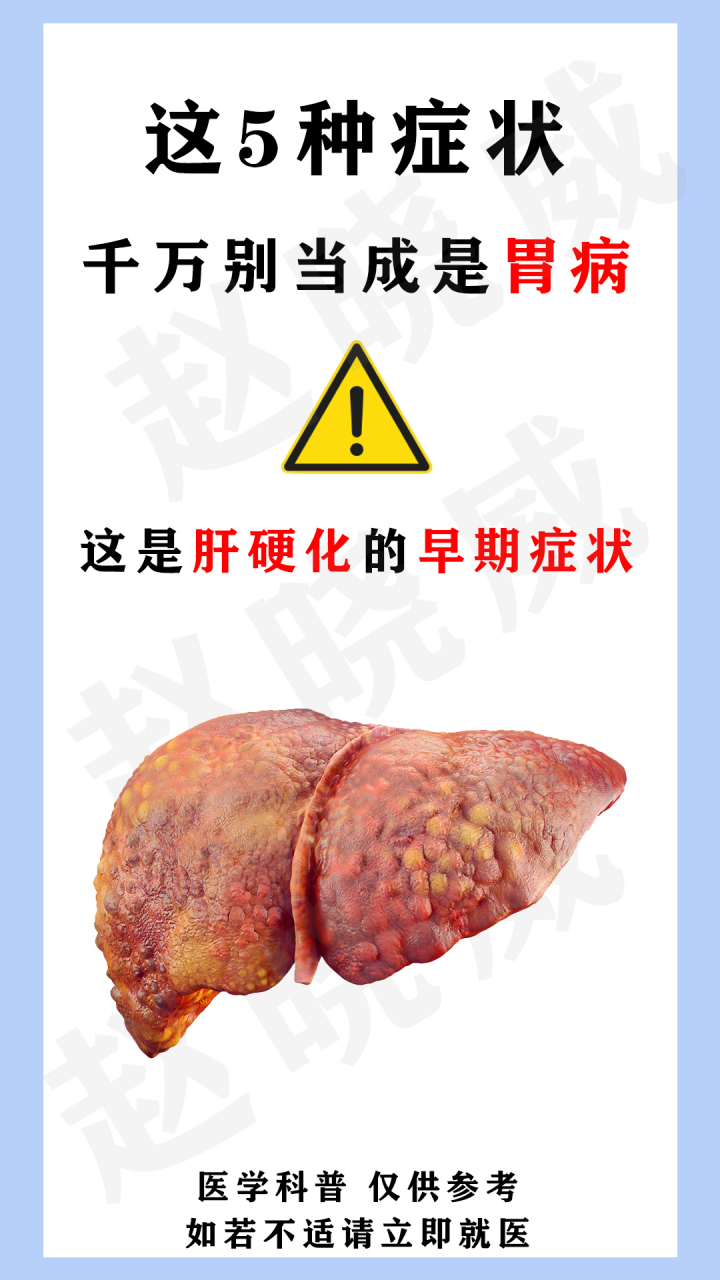 75这5种症状,千万别当成胃病,这是肝硬化的早期症状 87肝硬化有个