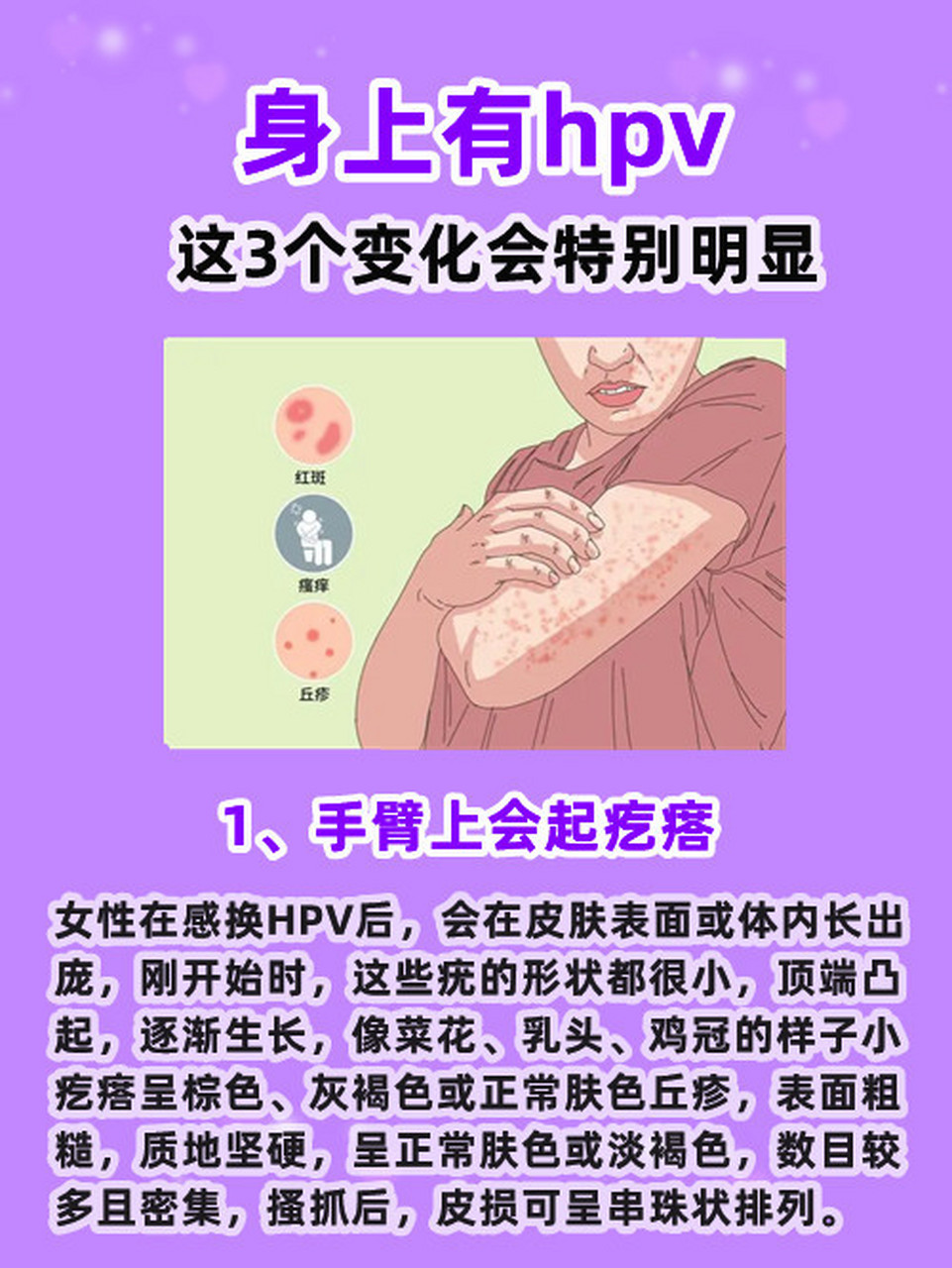 hpv感染早期症状女性图片