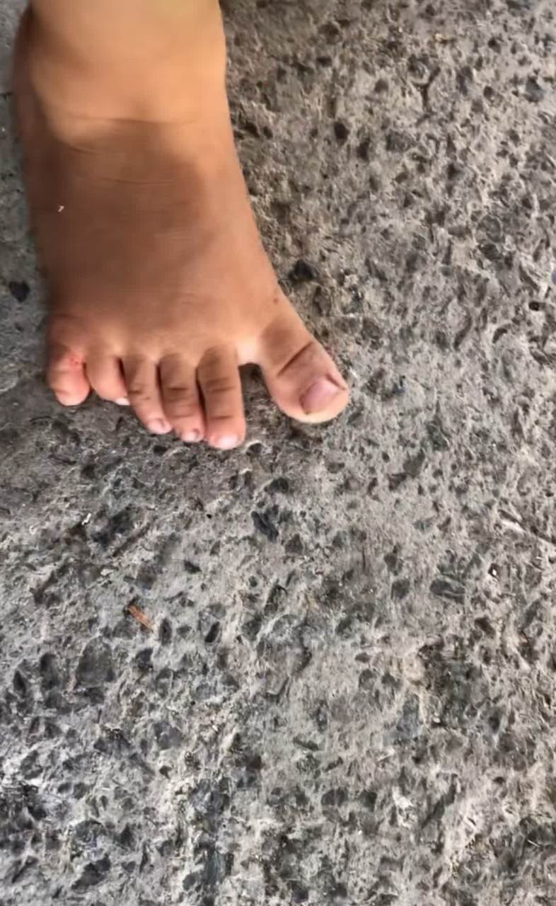 坚强的宝宝,十一个手指连着一颗心,不脱鞋就穿不了[汗][汗][得意]