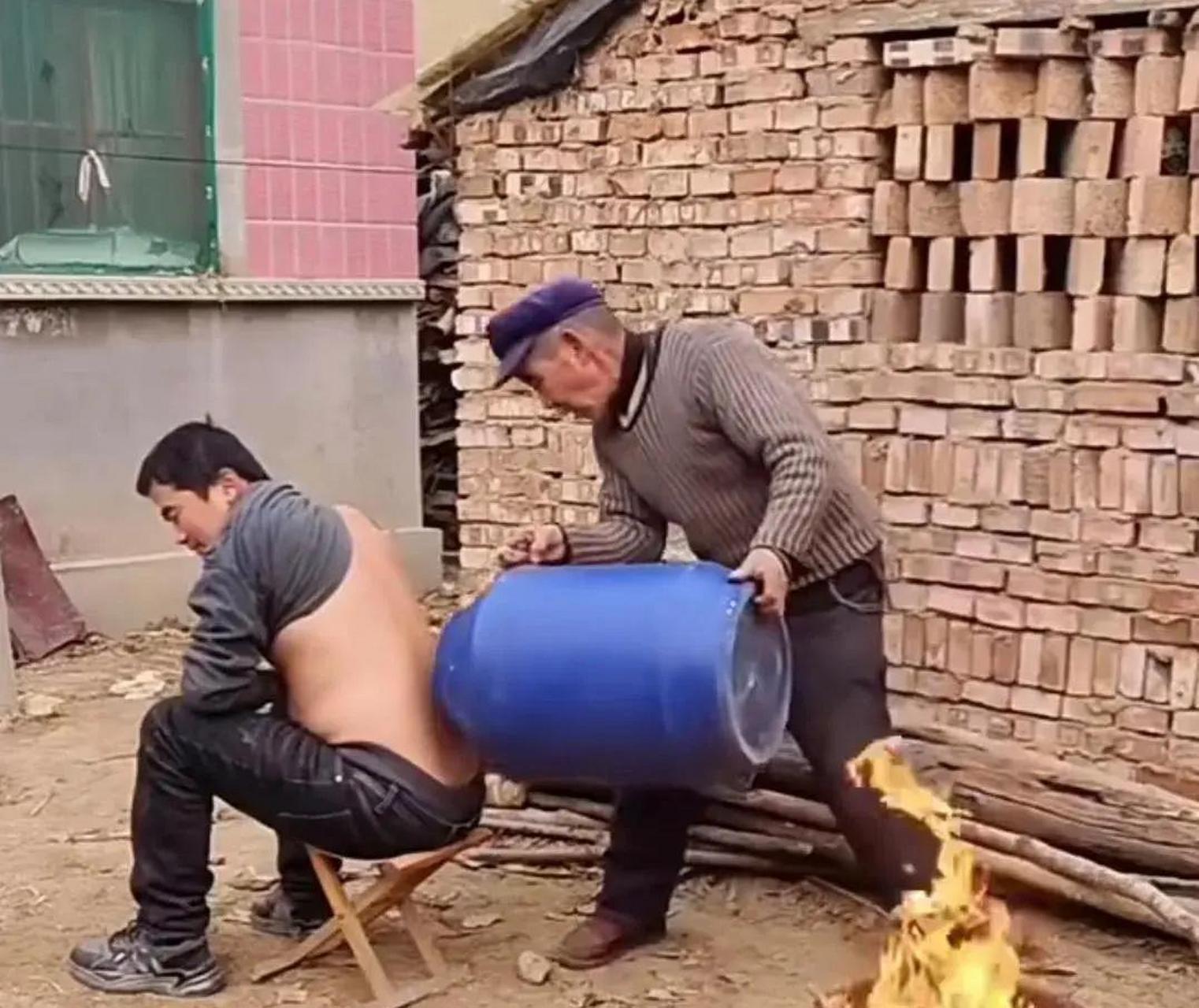 这拔罐是认真的吗? #趣图搞笑