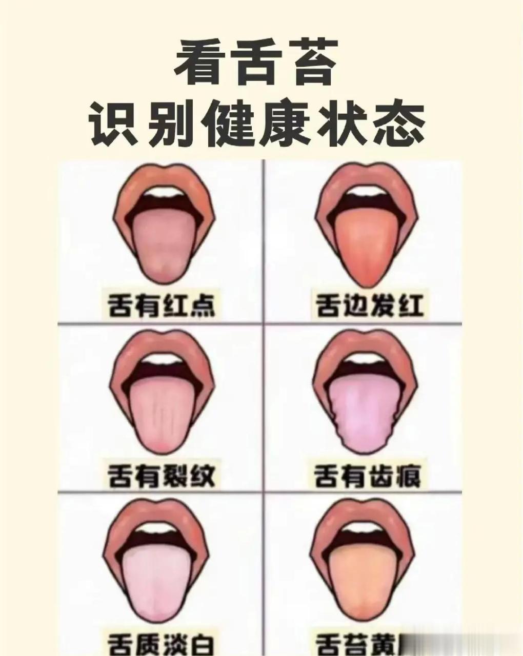舌苔的几种表现图片图片
