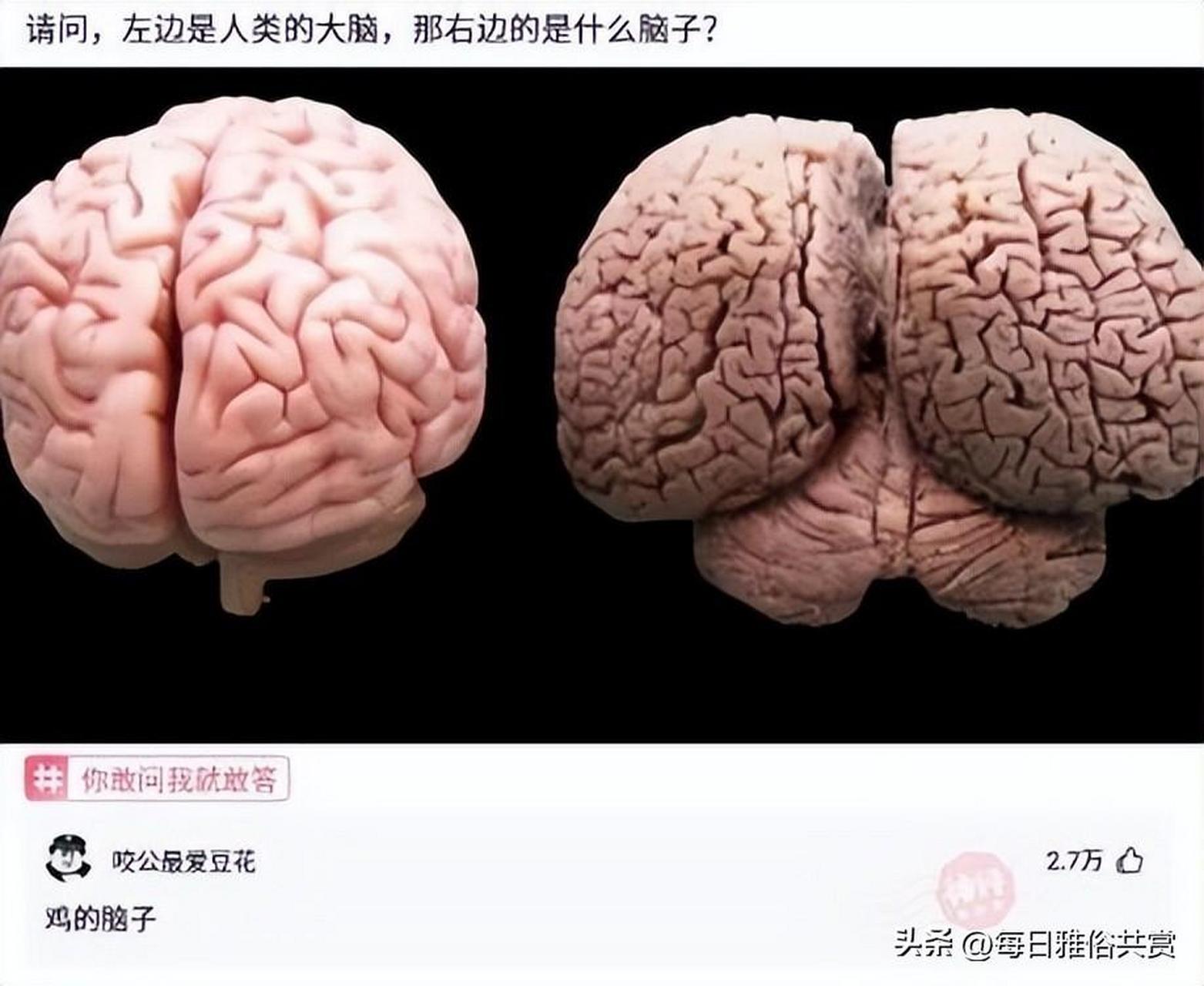 请问,左边是人类的大脑,那右边的是什么脑子?