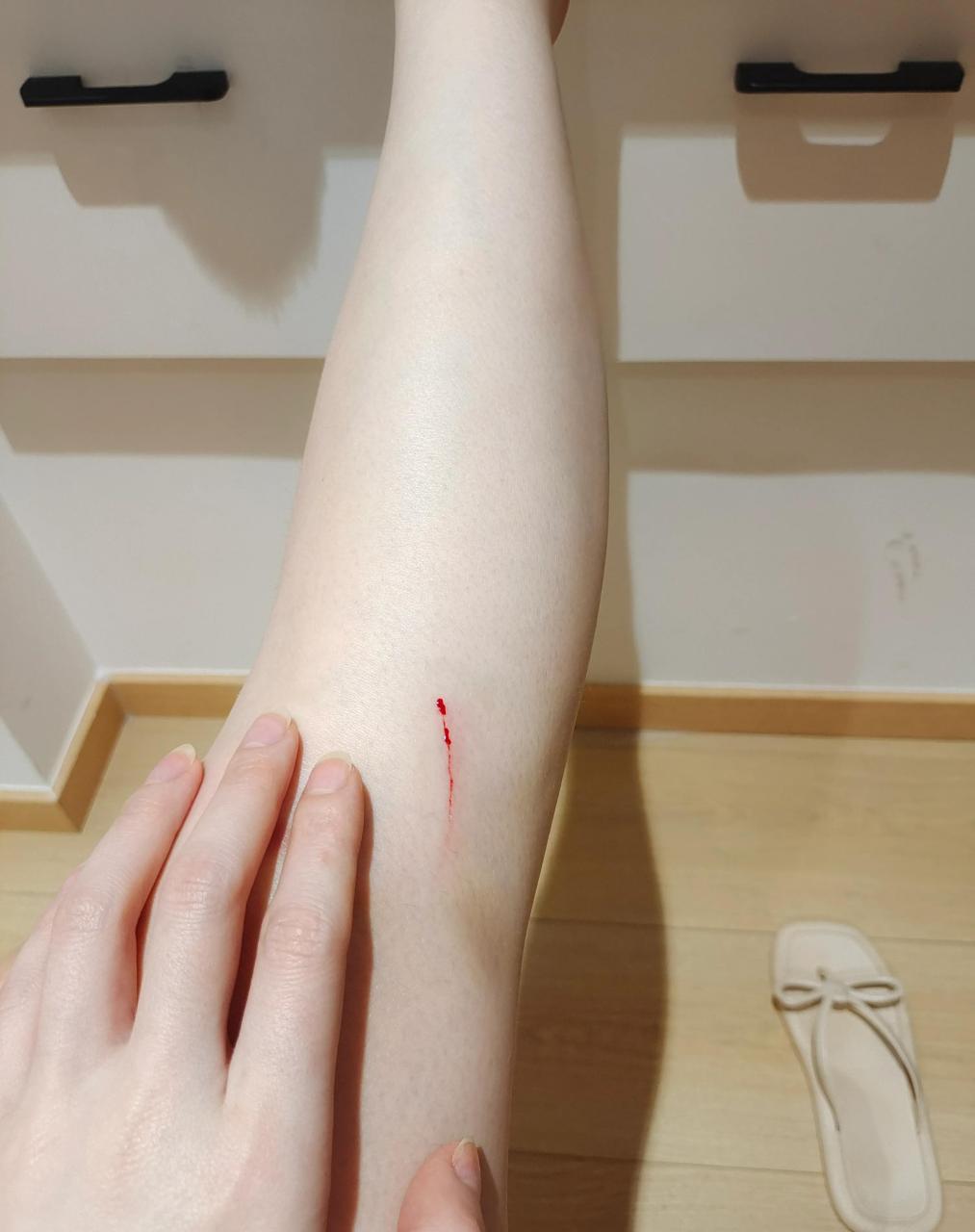 我这伤痕累累的腿呀,这夏天是不让过了嘛?