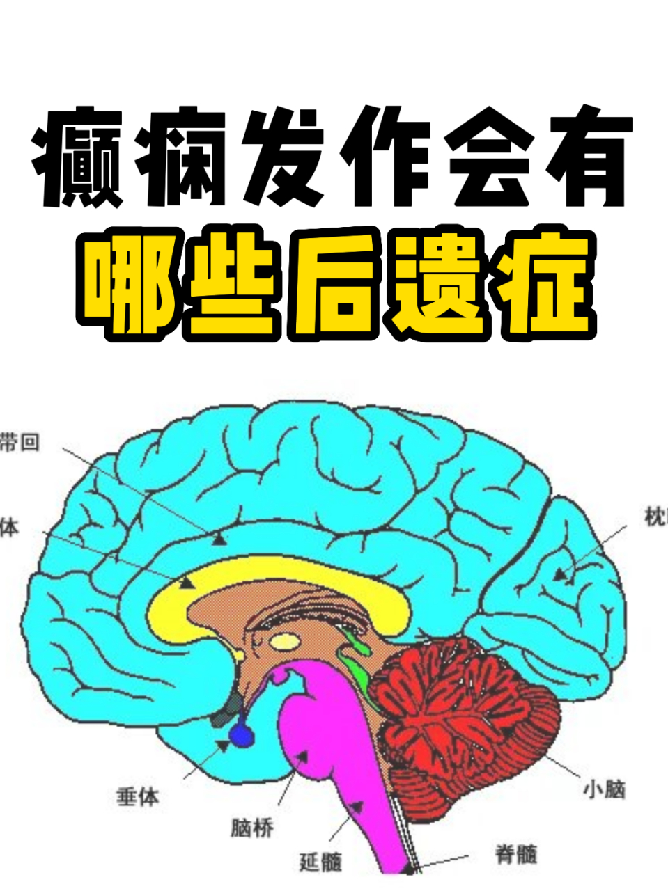 癫痫发作会有哪些后遗症 - 癫痫所致神经系统后遗症是指在癫痫长时间