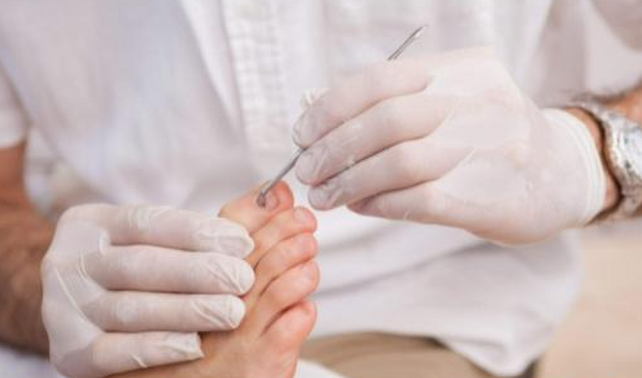 青岛金肤康皮肤病医院怎么样:甲沟炎挂什么科?