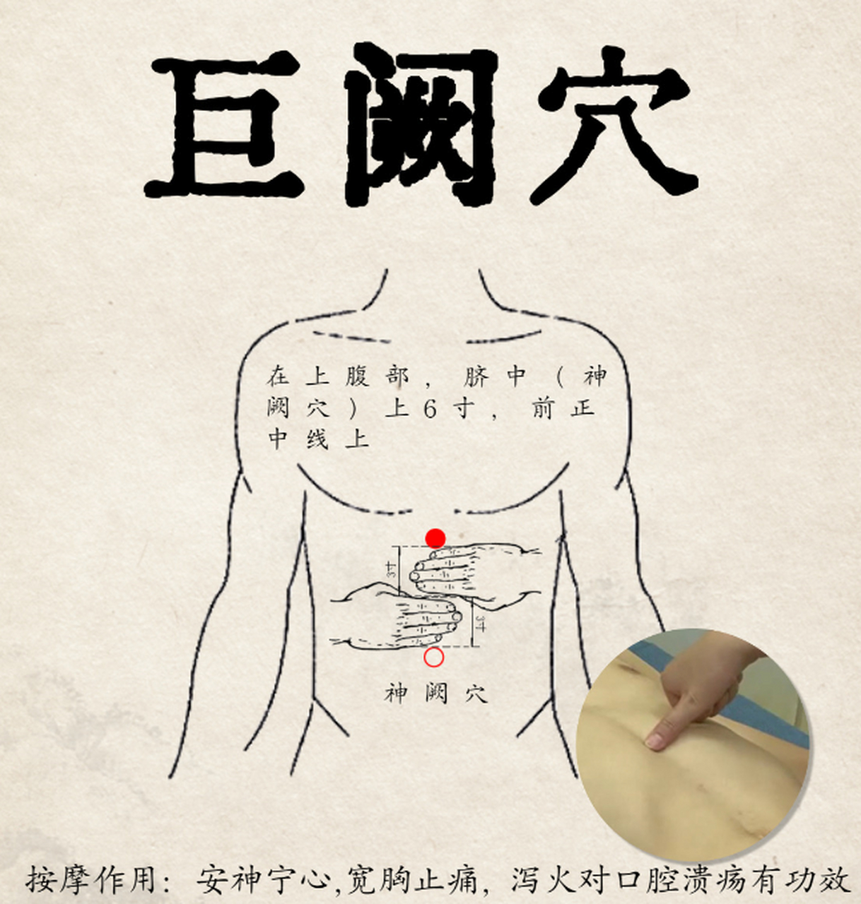 巨阙名意指胸腹上部的湿热水气在此聚集.