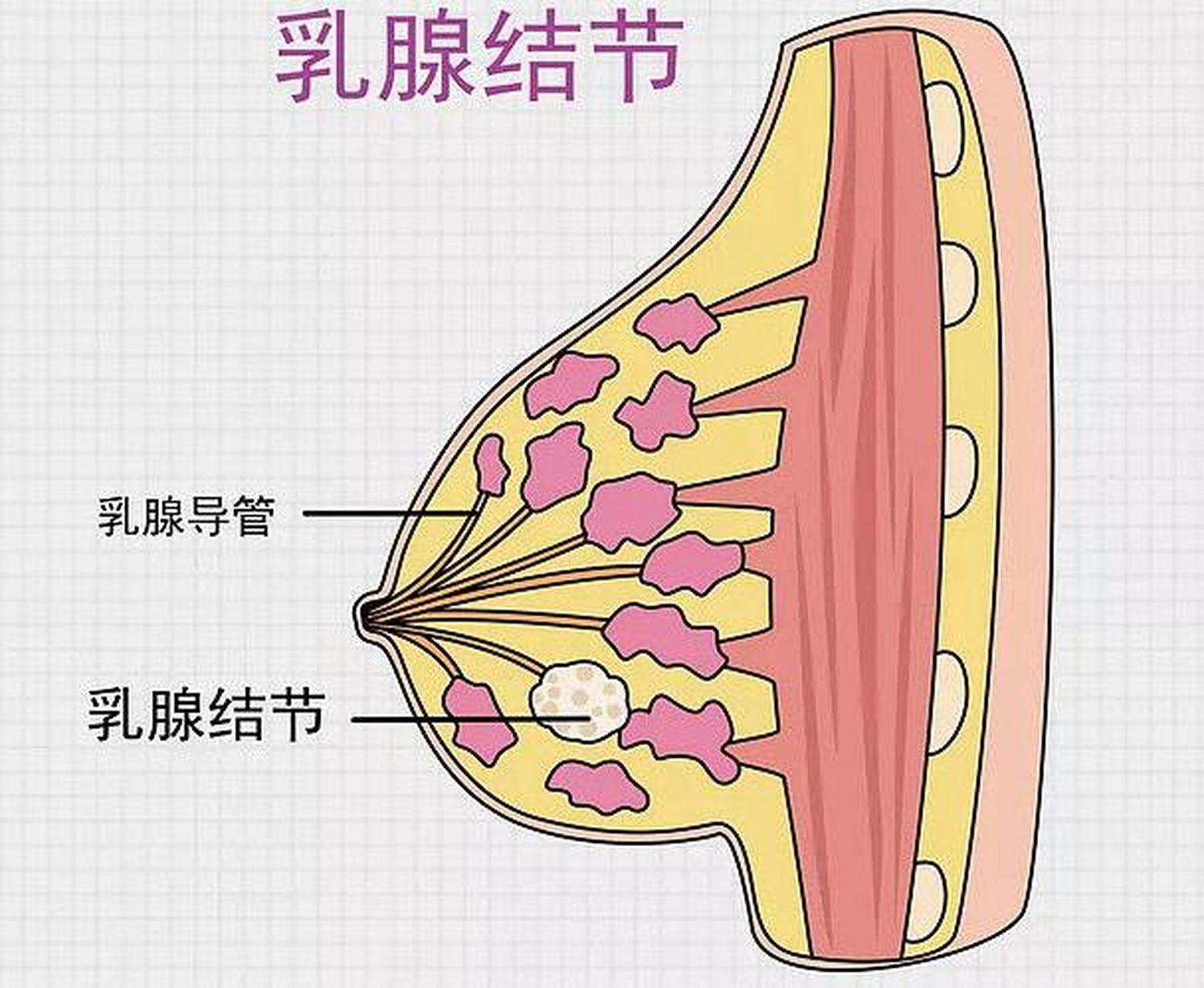 乳腺导管示意图图片