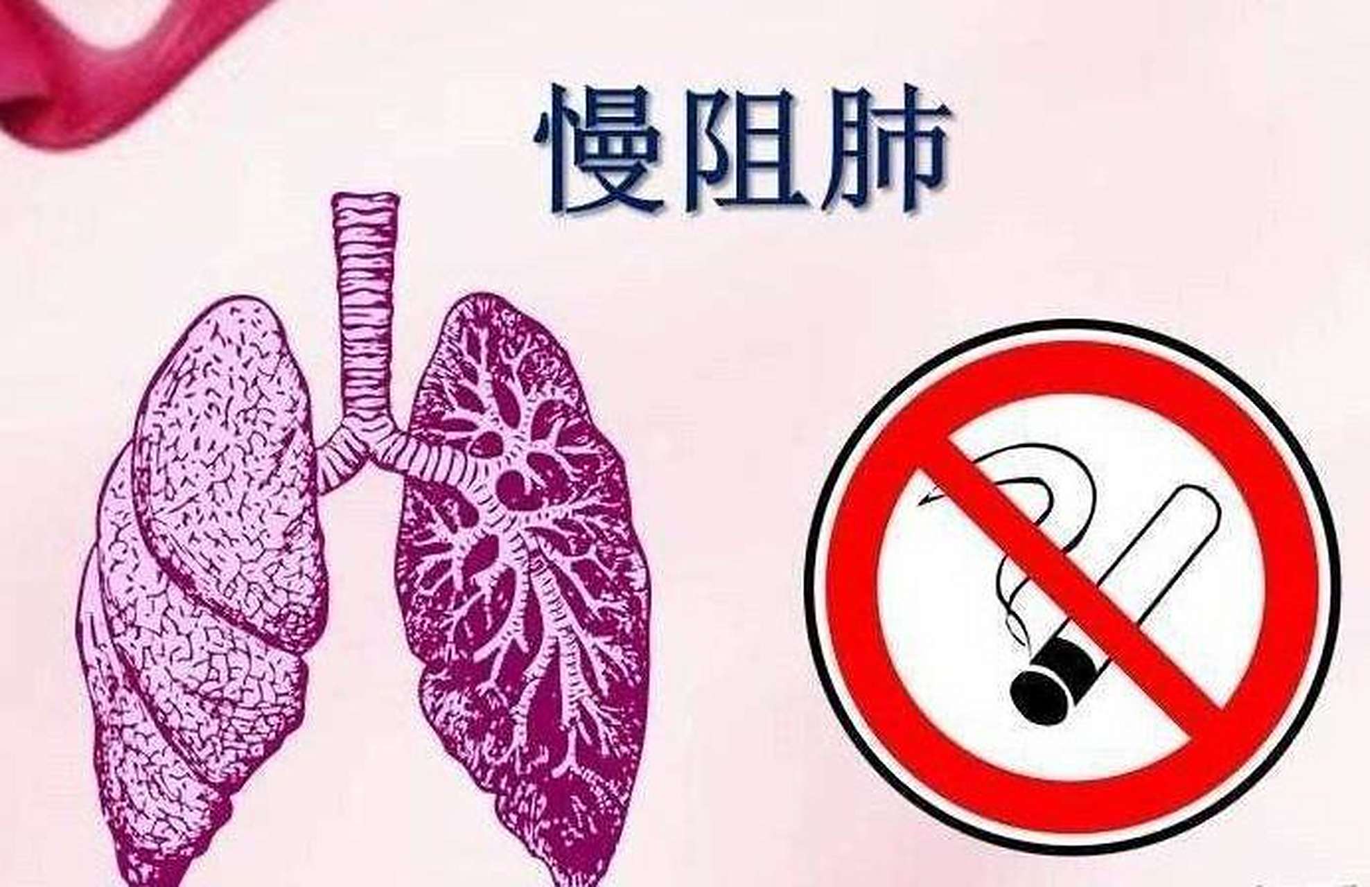 出现什么情况应该警惕,自己得了慢阻肺?  大家好,我是中医姜岳医生.慢