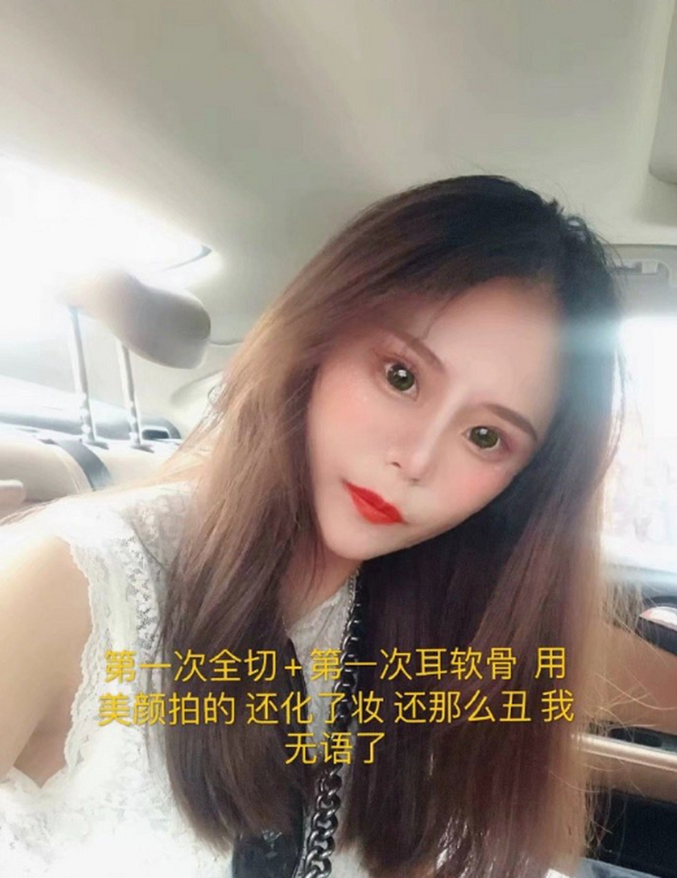 小z娜娜整容图片