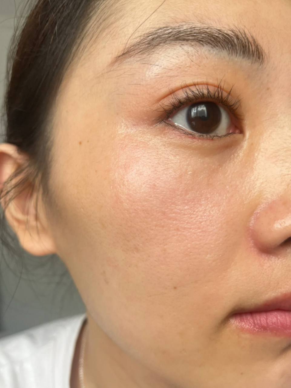 超皮秒祛斑是近年来非常流行的一种祛斑技术,它采用高能量激光,能够