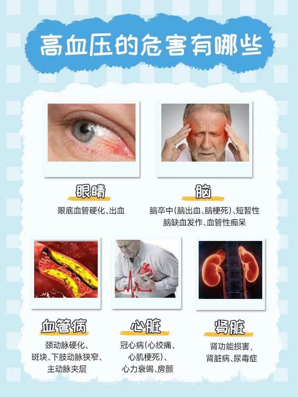 反复或长期的控制不住高血压有多可怕,你知道吗?