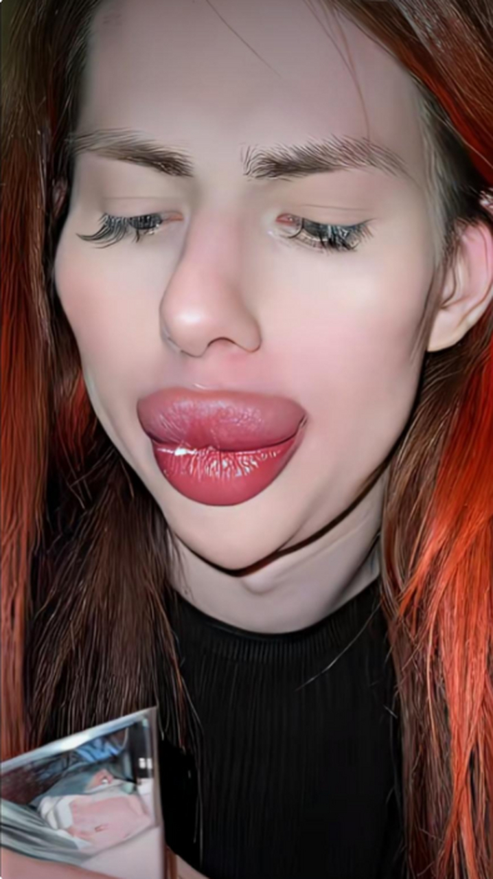 这是嘟嘟唇还是香肠唇!