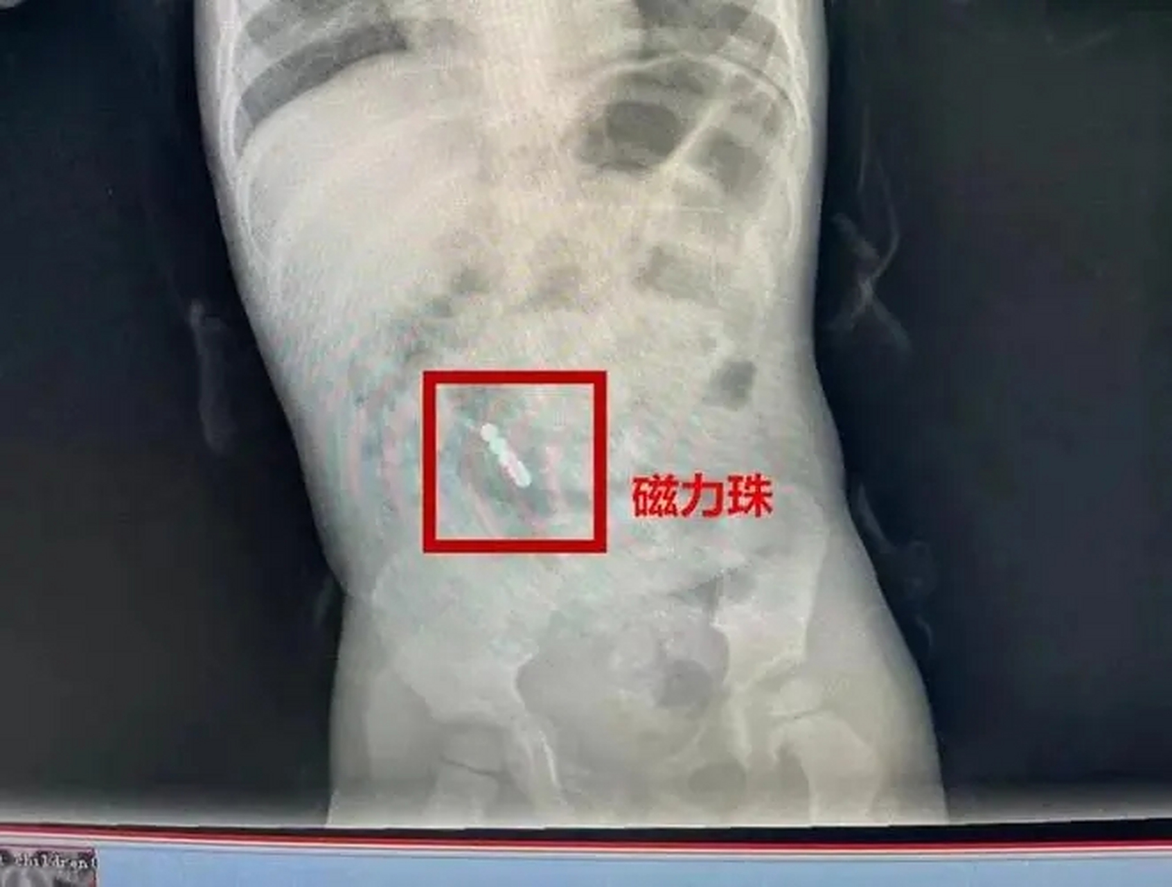 吃了磁力珠多长时间有反应_吃磁力珠子症状是什么（如果吃了磁力珠几天有反应）