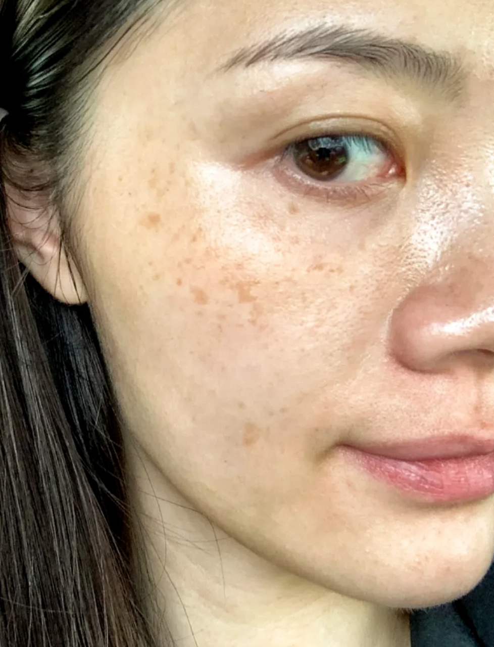 色素斑,是肌肤上的一种常见问题,给人们带来了不少困扰.它们的出现让