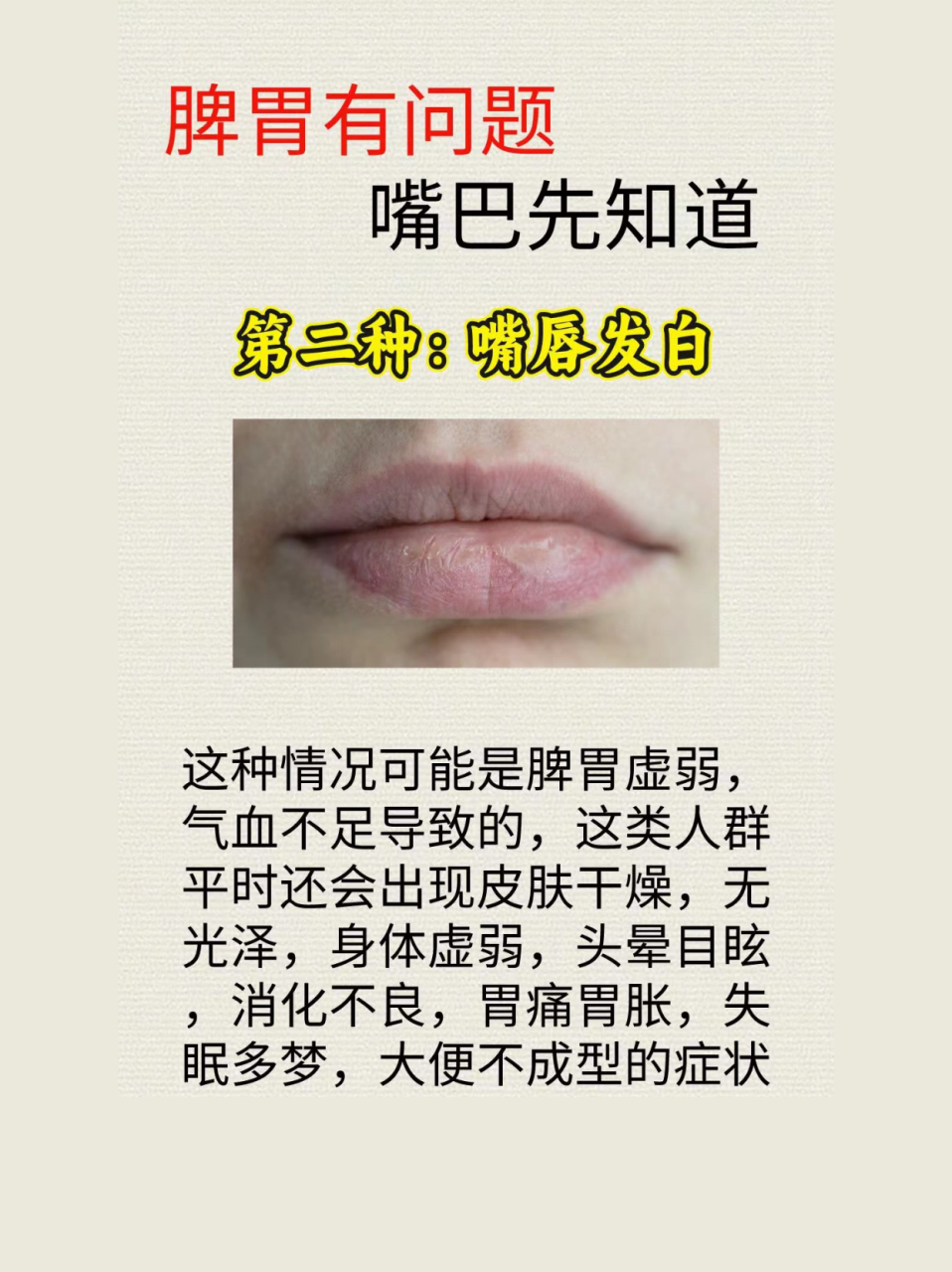 脾胃有问题 嘴巴先知道!