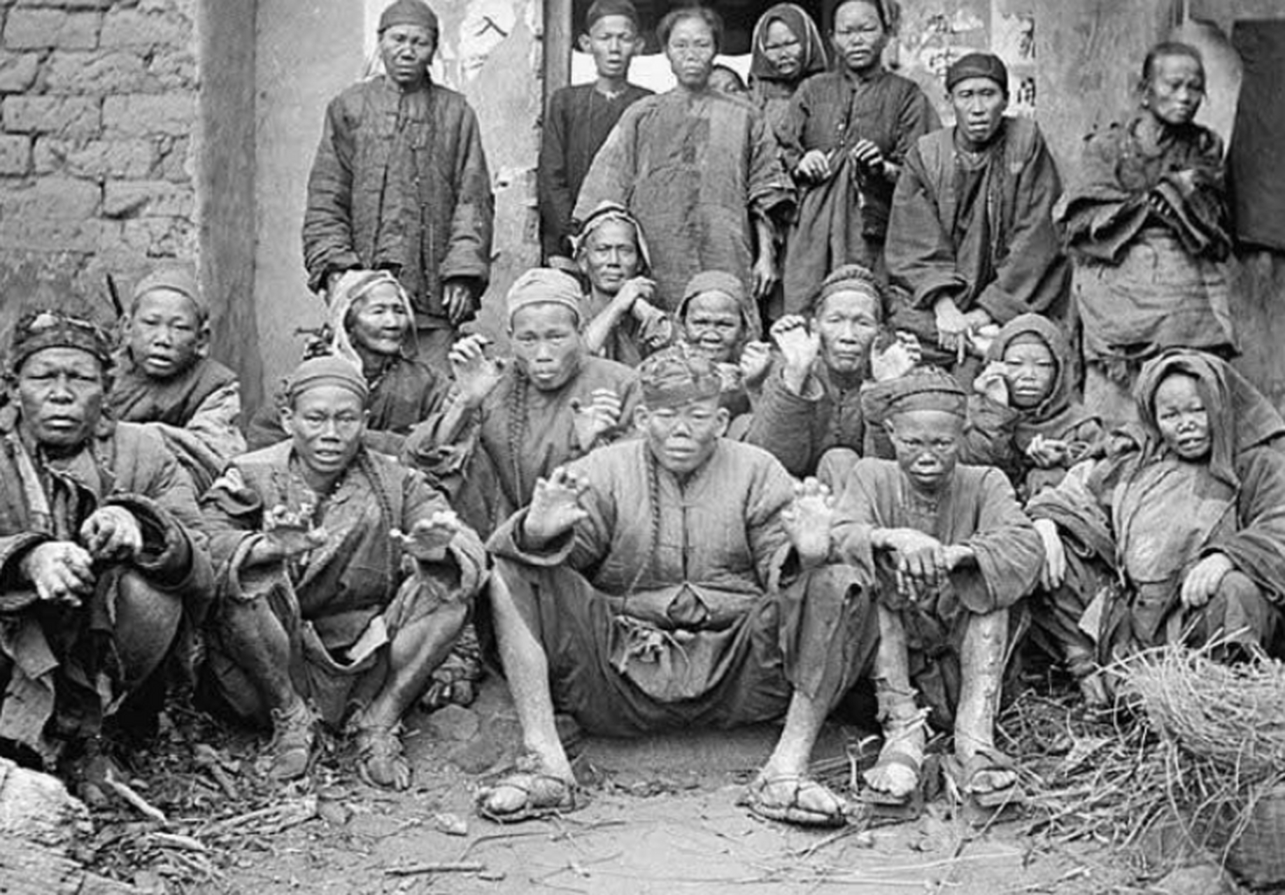 清朝老照片:图为晚清时期阳江附近的麻风病人,这些病人的面孔非常吓人