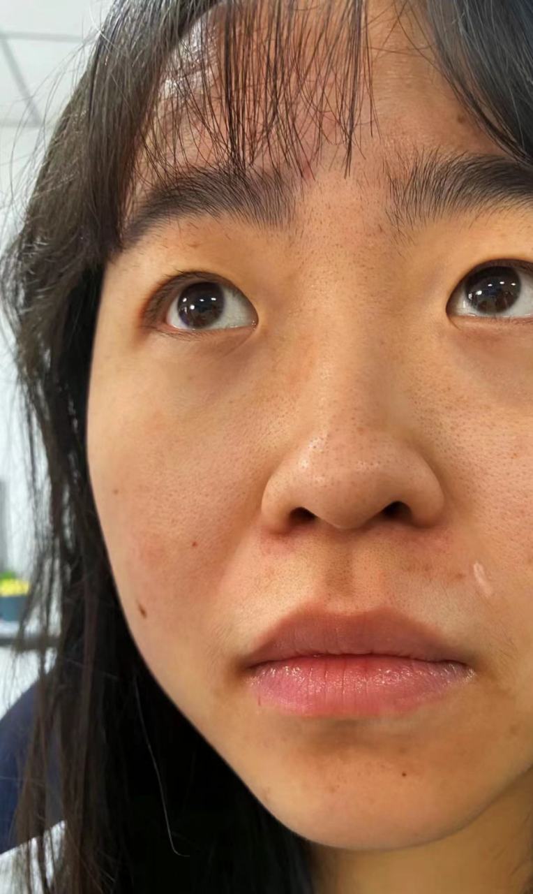 然而,不用担心,有许多方法可以改善肤色暗黄,让你拥有明亮健康的肌肤.