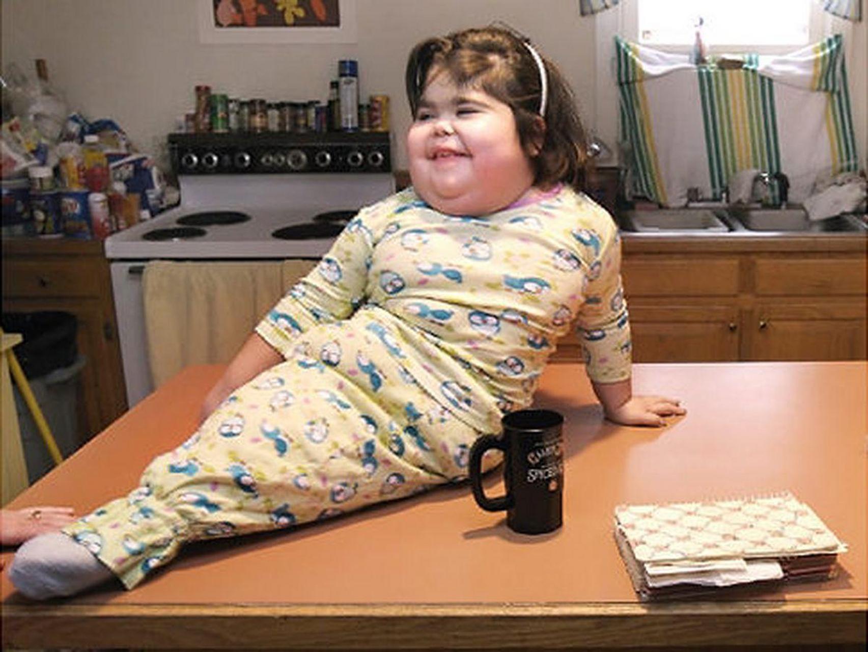 shiloh pepin,美人鱼综合症患者,这是一种罕见的先天畸形,因为患者