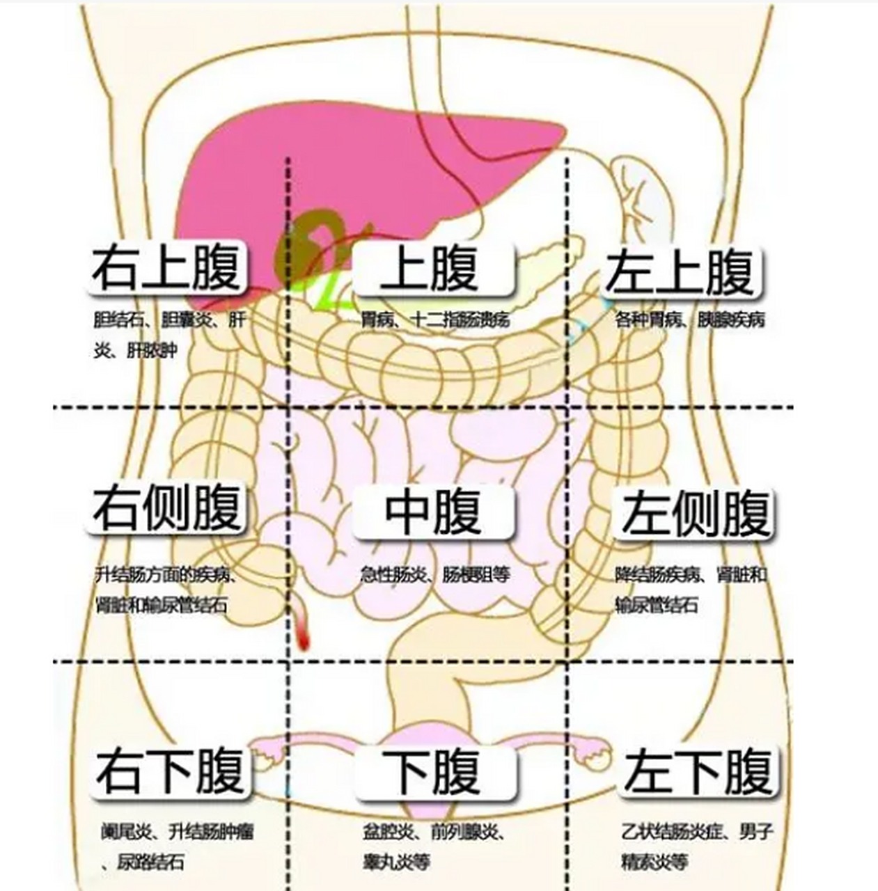 中医教你,辨腹痛,识疾病,方便对照——腹痛九宫格