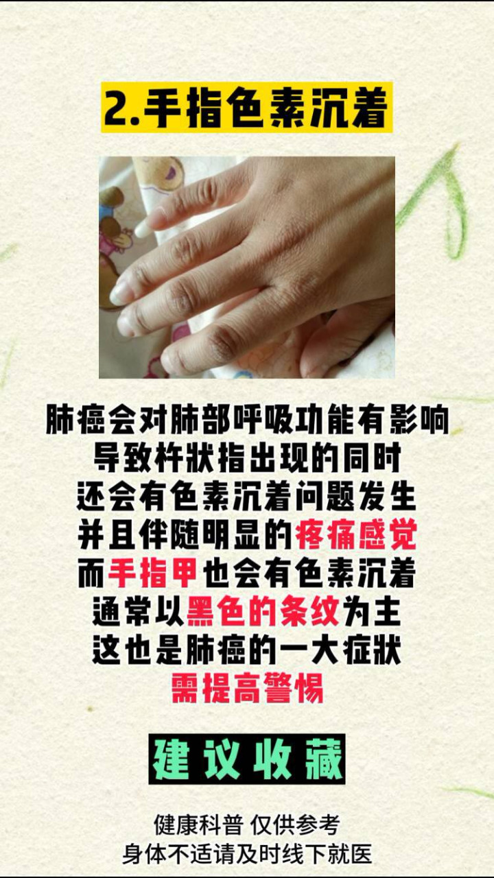 手指出现四个特征 你离肺癌眞的很近了#肺