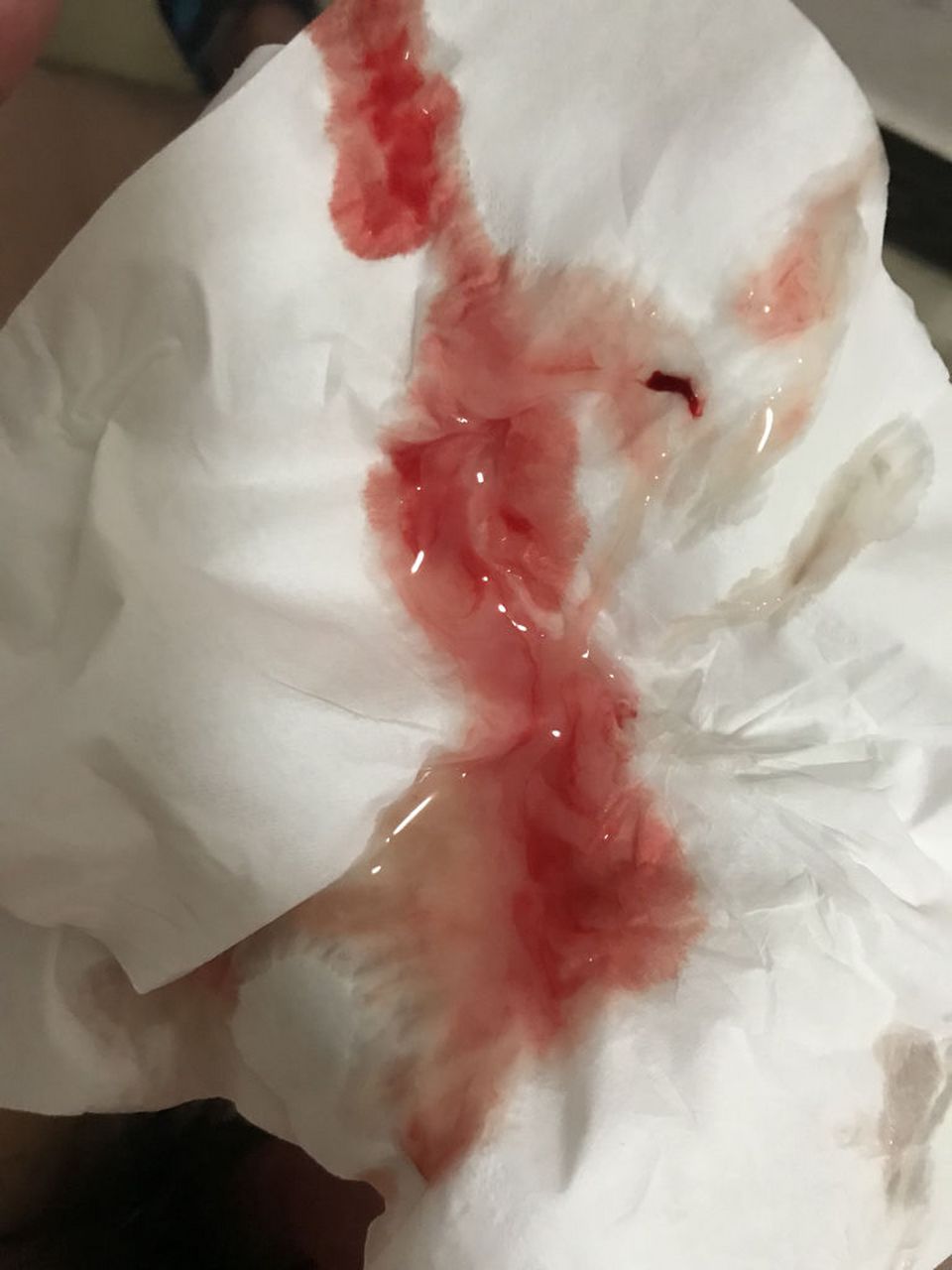 血精多见于哪类人群?