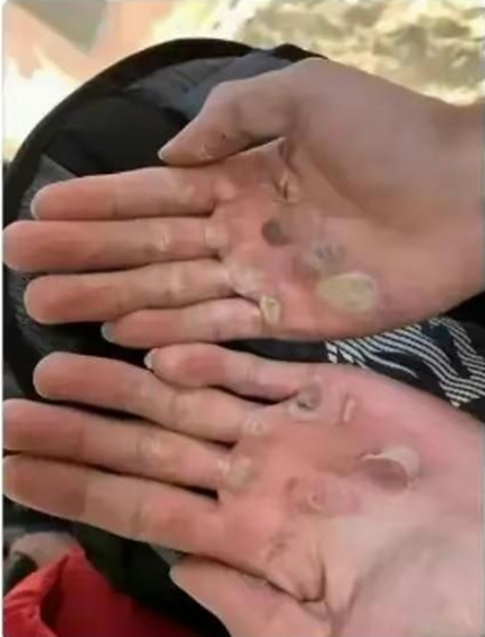 我这样的手像不像在工地干活了?