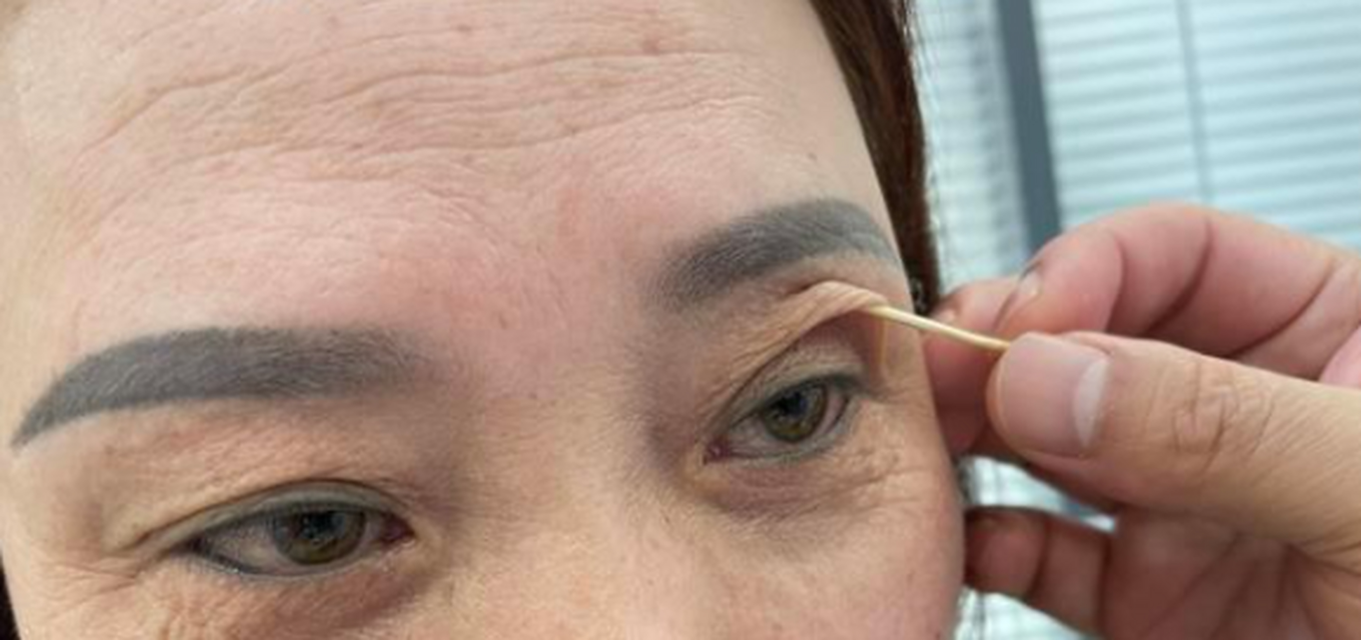 像图中的这样松眼皮,我是不建议做拉皮的. 因为真的太松了,没有任何的