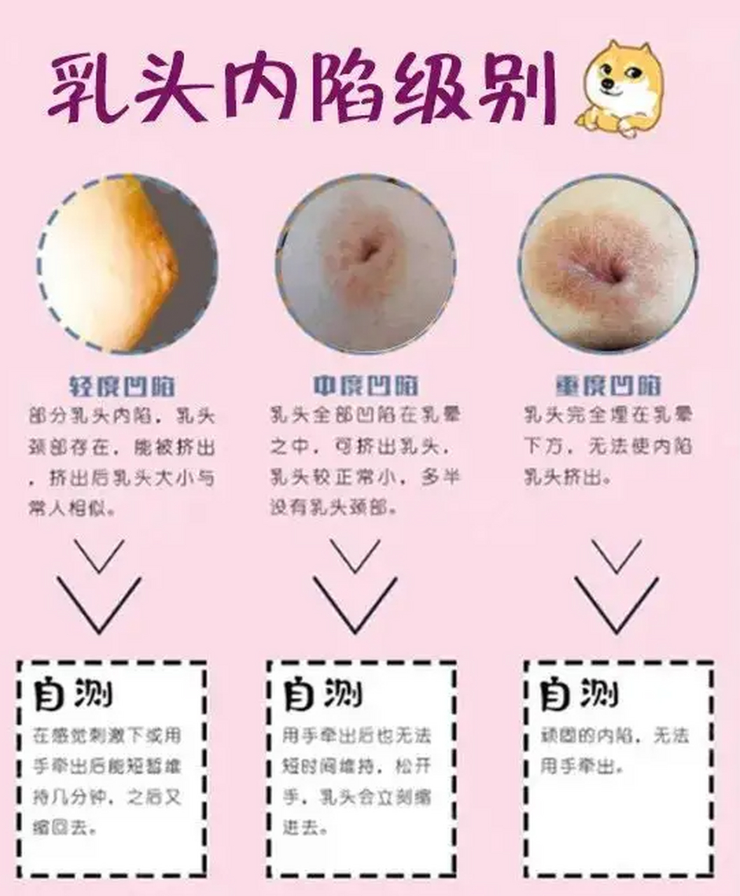 有些妈妈从小乳头就比较小,而且内陷,这是怎么回事?