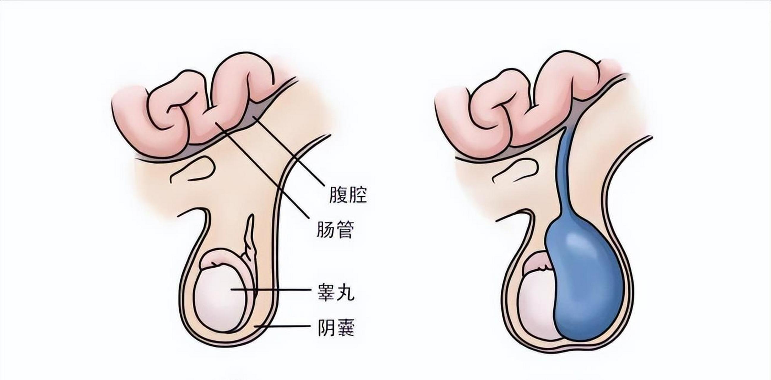 睾丸正常的样子图片