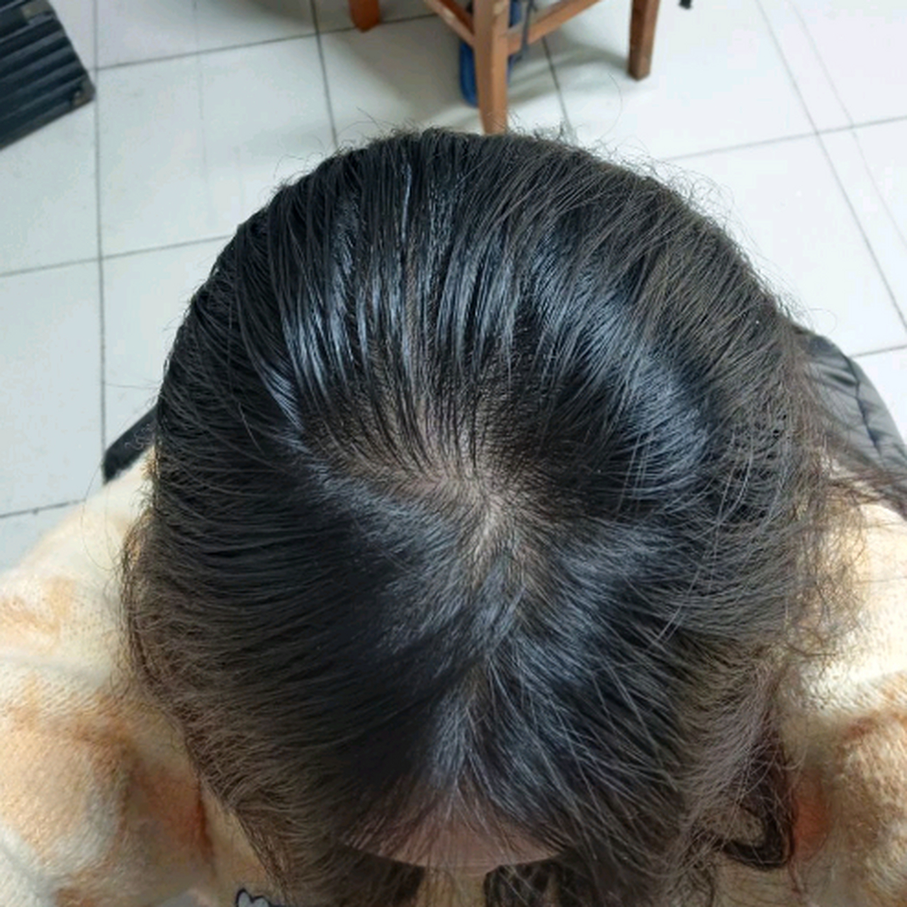发型变得这么稀疏了,是不是要秃头了