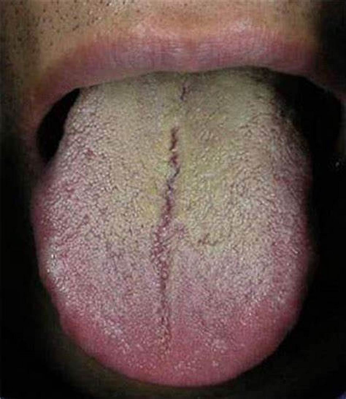 如何看待我们的舌头来区分脏腑,我来教给大家:  第一,舌头的前面,舌尖
