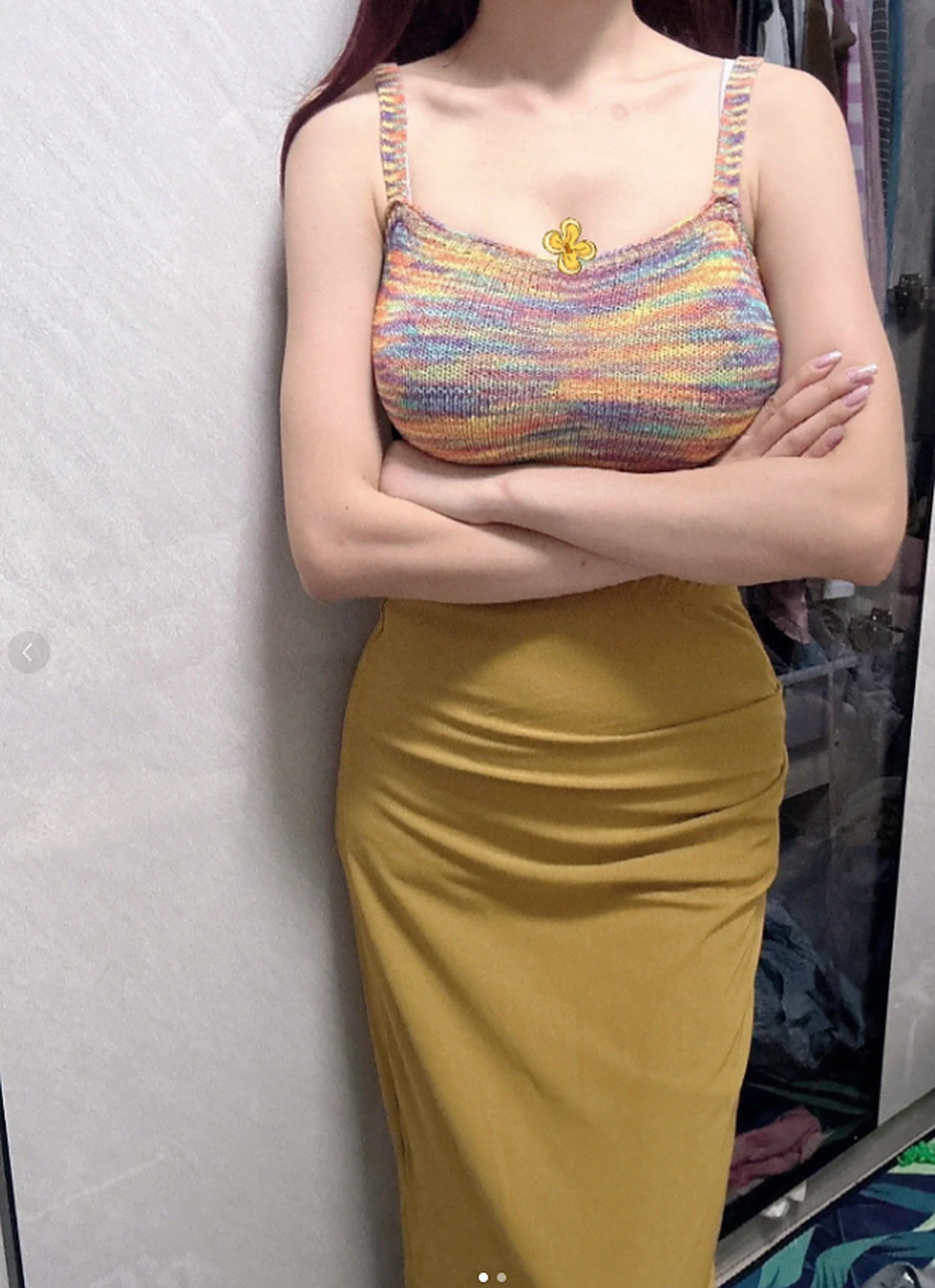 我之前是167cm,g杯,体重130斤,手术缩小到c杯了,缩胸已经半年了,目前