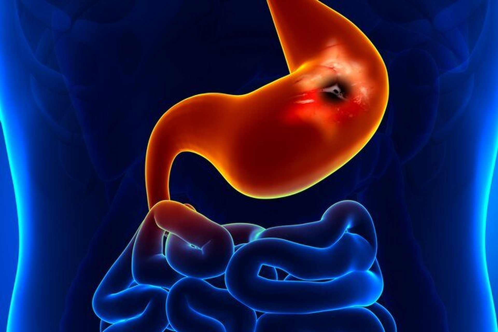 前段时间,有位读者给我留言,想让我说说胃溃疡,胃痛的中医辩证.